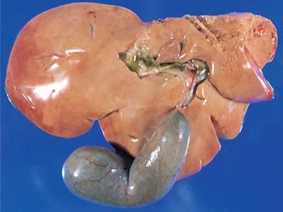 Image for Liver