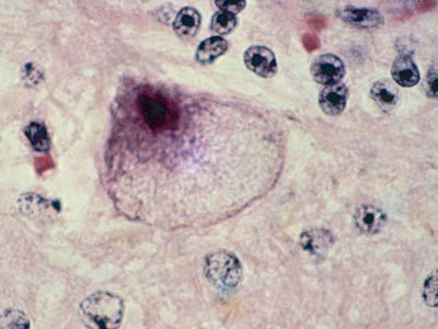 Image for Central nervous system