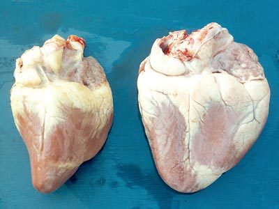 Image for Cardiovascular system