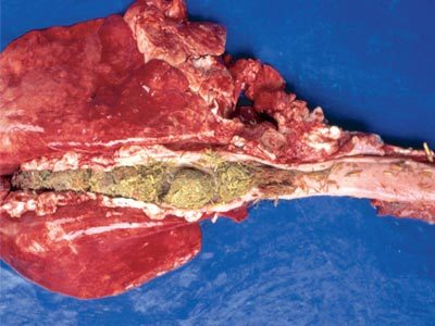 Image for Gastrointestinal tract