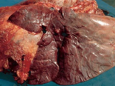 Image for Respiratory system
