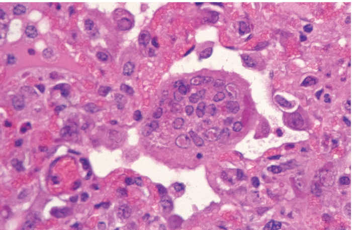 Peste des petits ruminants