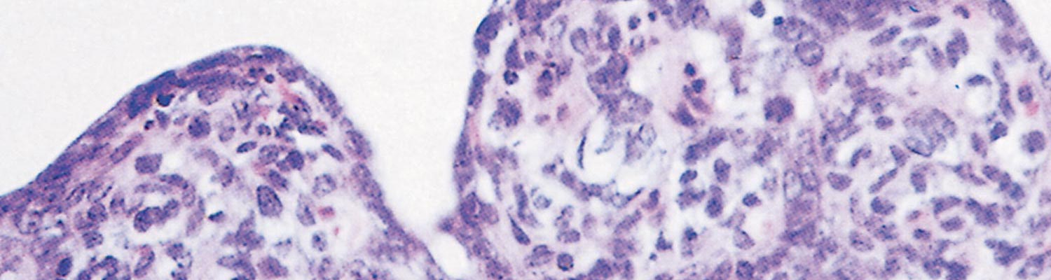Porcine transmissible gastroenteritis