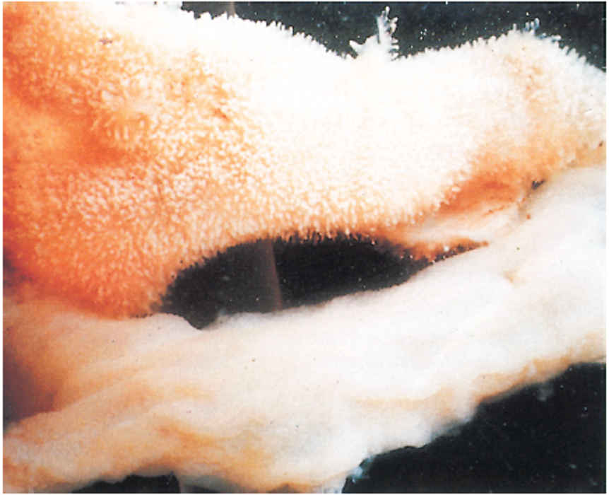 Transmissible gastroenteritis