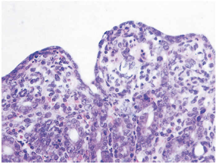Transmissible gastroenteritis