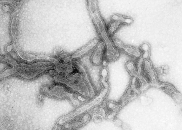 Bovine respiratory syncytial virus infection