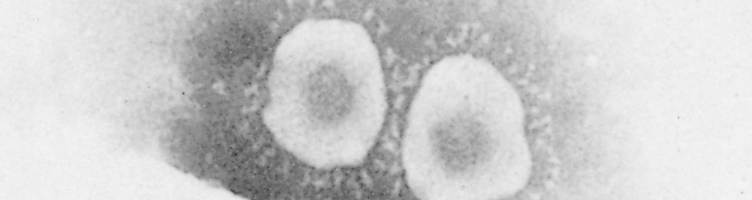 Porcine epidemic diarrhoea