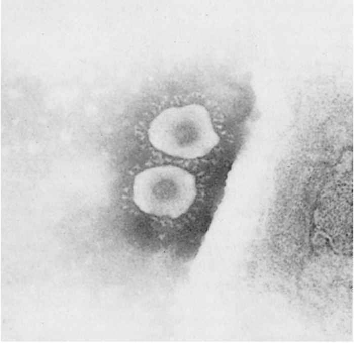 Porcine epidemic diarrhoea