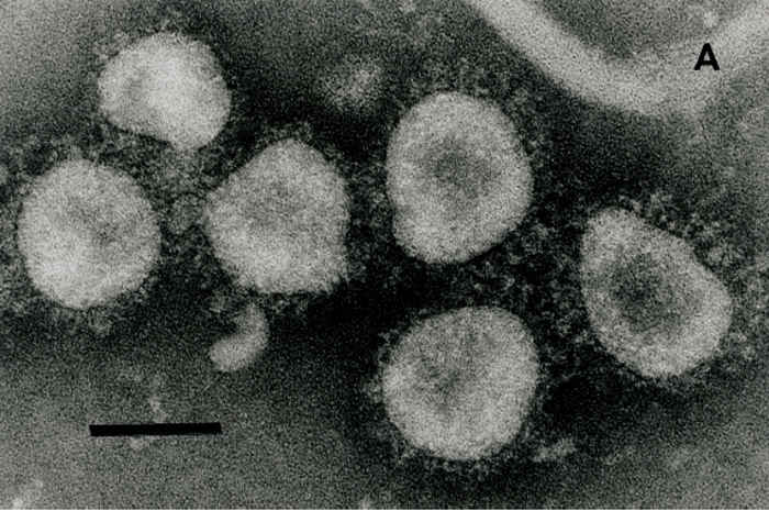 Bovine coronavirus infection