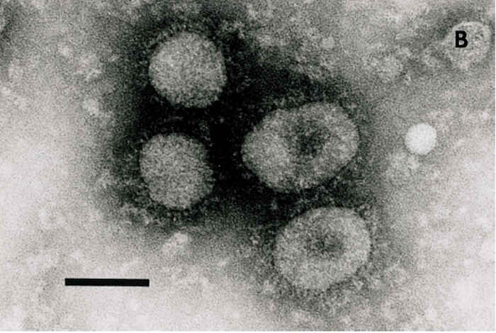 Bovine coronavirus infection
