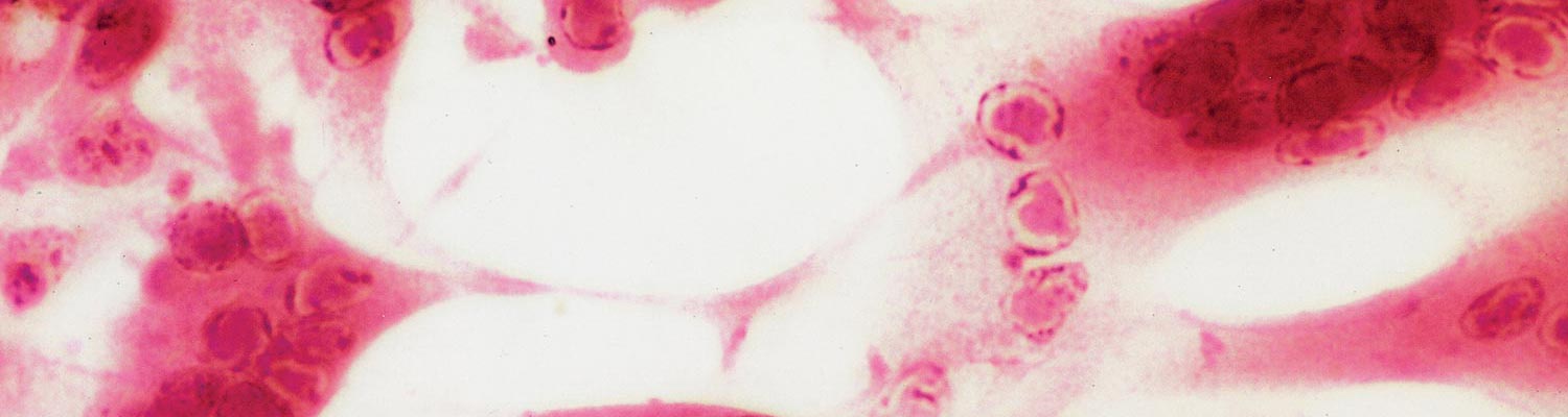 Bovine alphaherpesvirus 2 infections