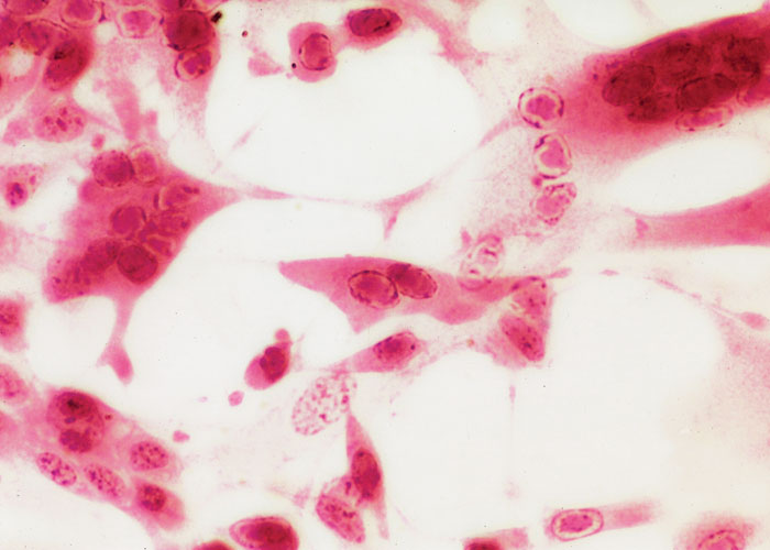 Bovine herpesvirus 2 infections