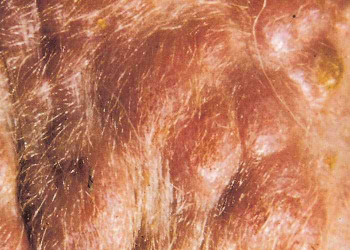 Sheeppox and goatpox