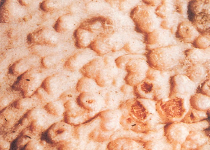 Sheeppox and goatpox