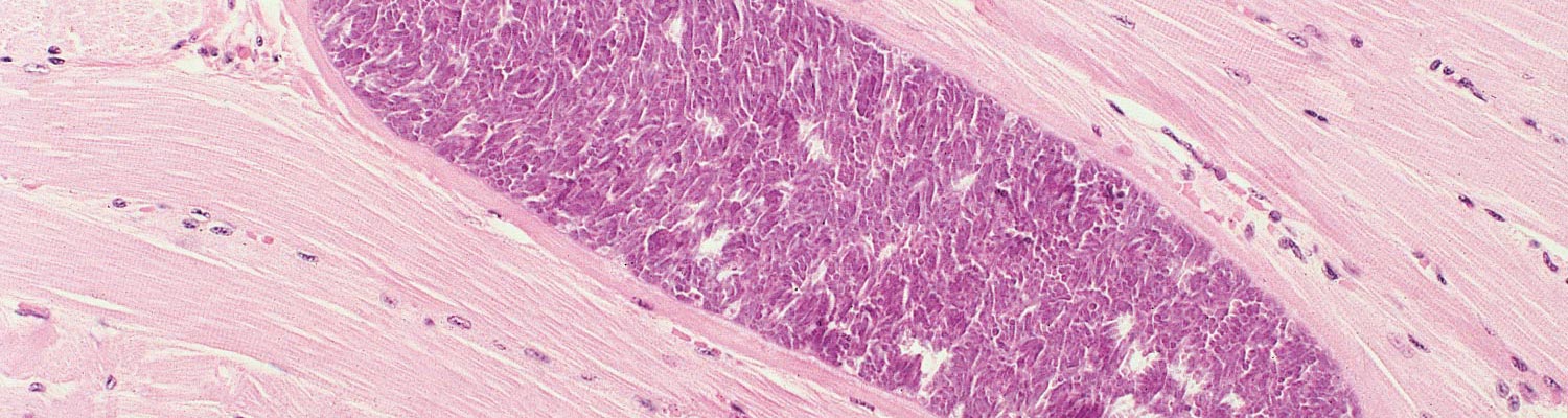 Sarcocystosis