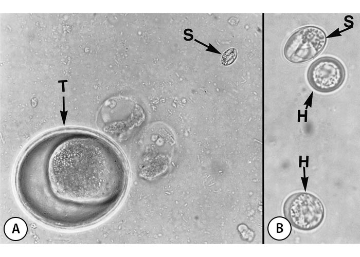 Sarcocystis
