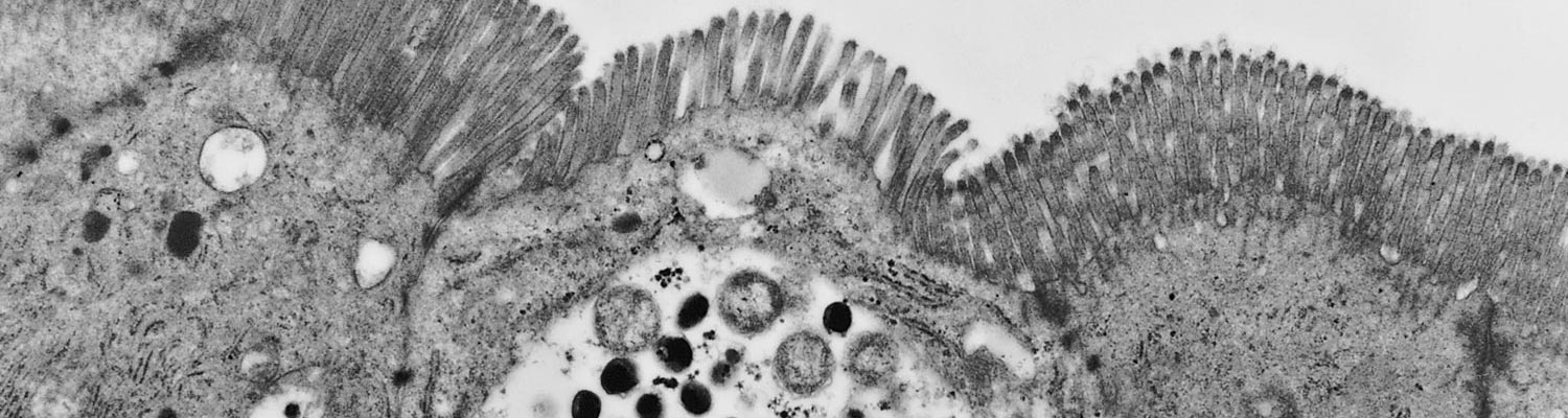 Chlamydiosis