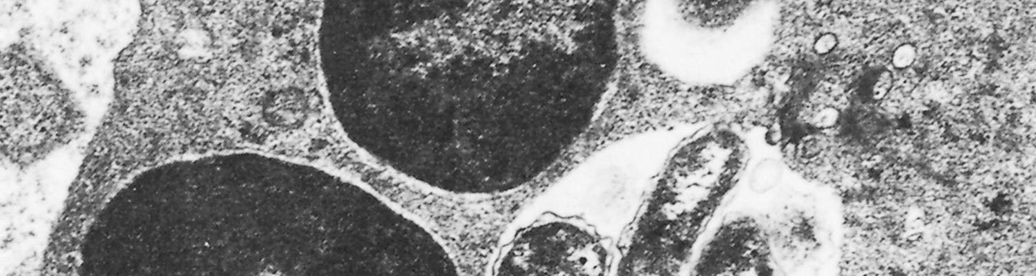 Lesser known rickettsial infections in animals and humans