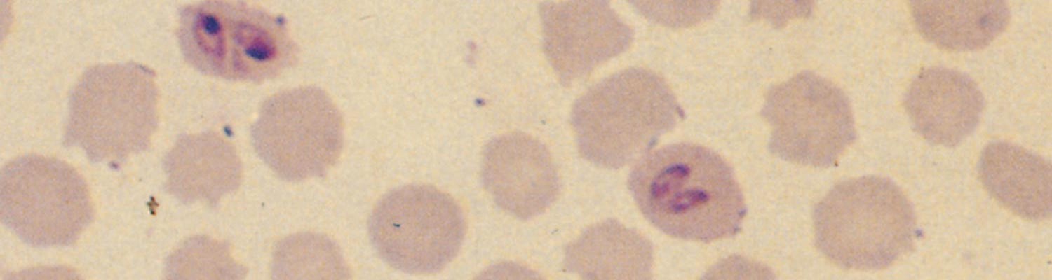 Bovine babesiosis