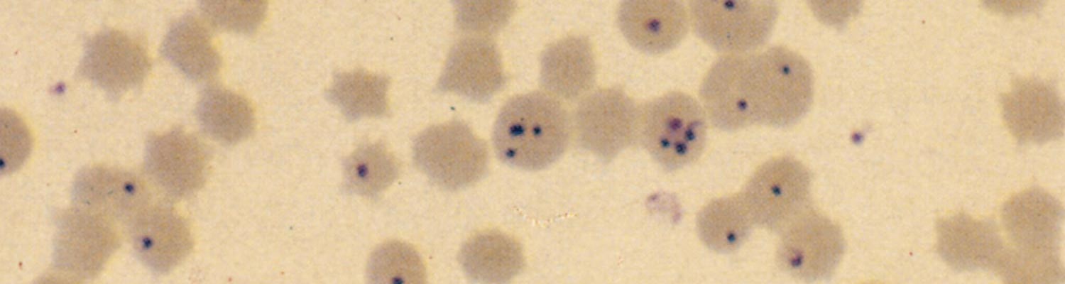 Equine piroplasmosis