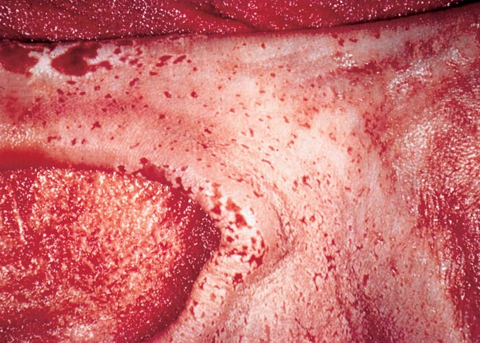 Bovine viral diarrhoea and mucosal disease