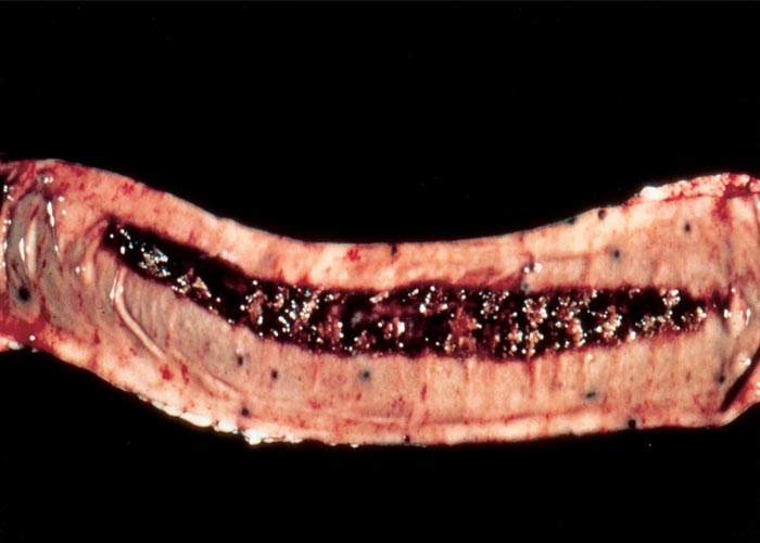 Bovine viral diarrhoea and mucosal disease