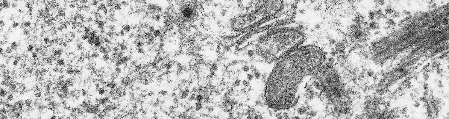 Ibaraki disease in cattle