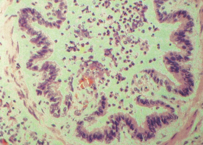 Bovine ephemeral fever