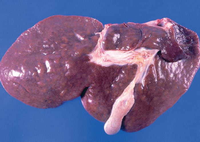 Liver