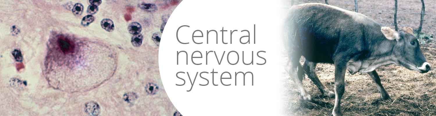 Central Nervous System