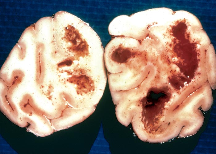 Central Nervous System
