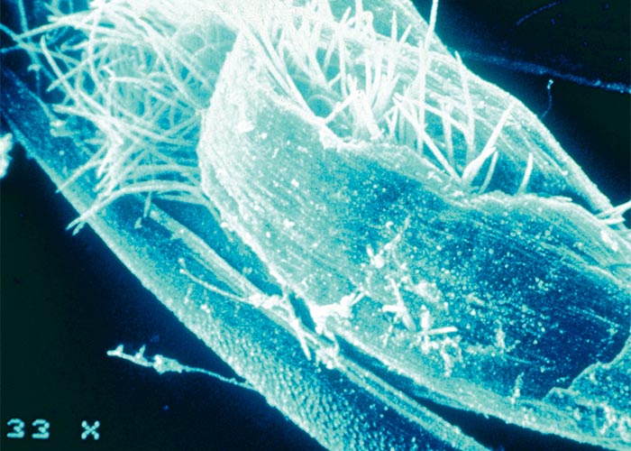 Central Nervous System