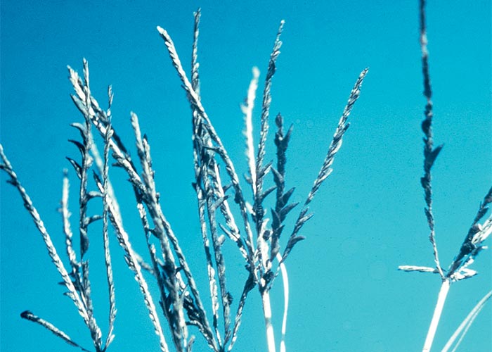 Central Nervous System