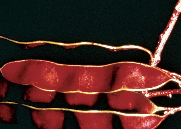 Central Nervous System