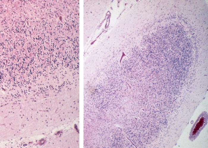 Central Nervous System