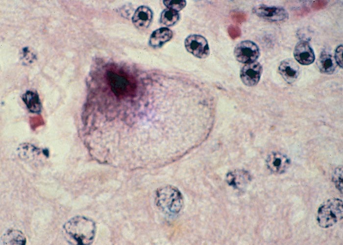 Central Nervous System