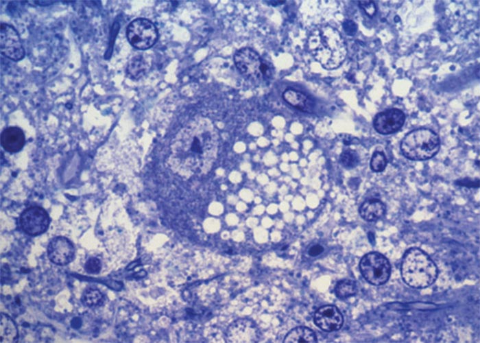 Central Nervous System