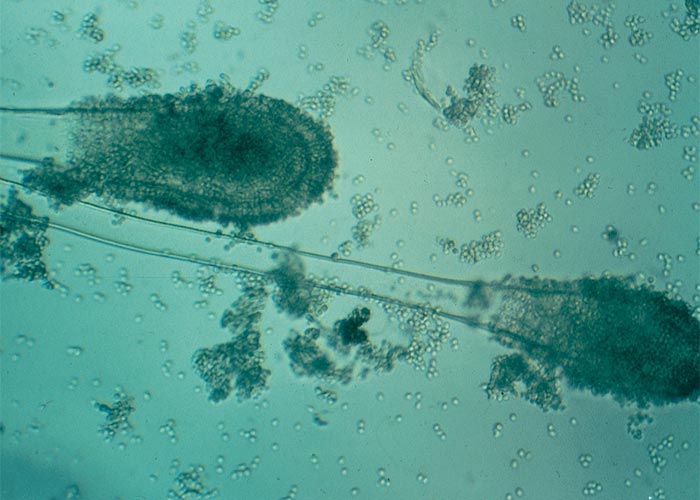 Central Nervous System