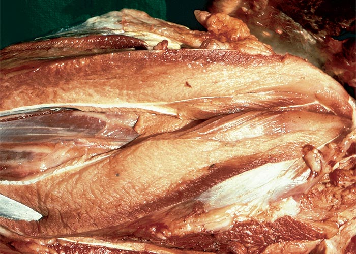 Central Nervous System