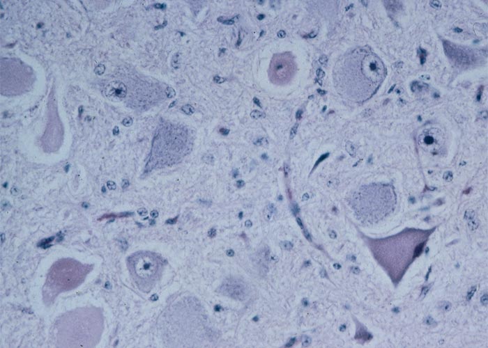 Central Nervous System