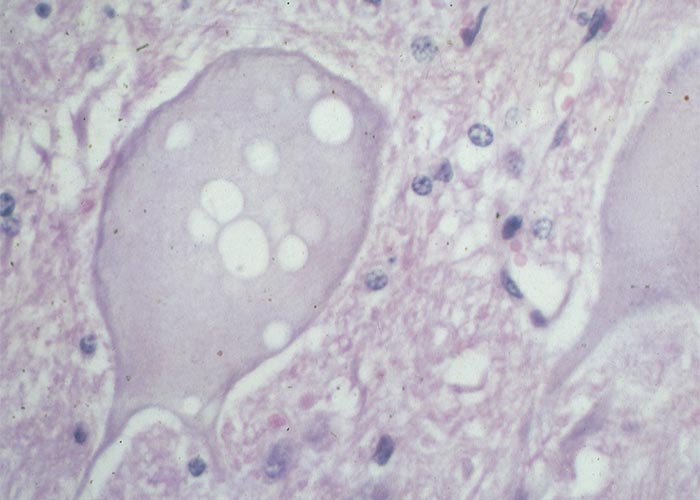 Central Nervous System