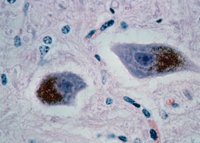 Central Nervous System