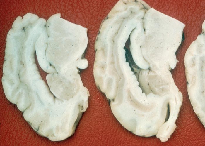 Central Nervous System