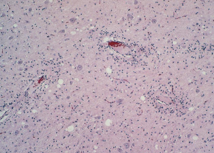 Central Nervous System