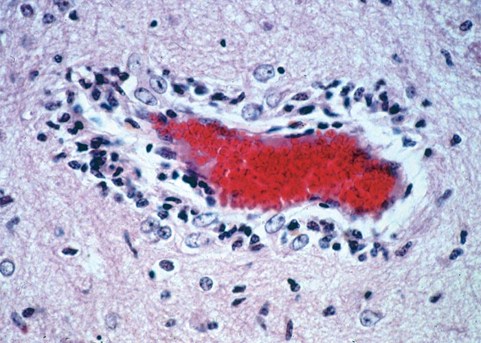 Central Nervous System