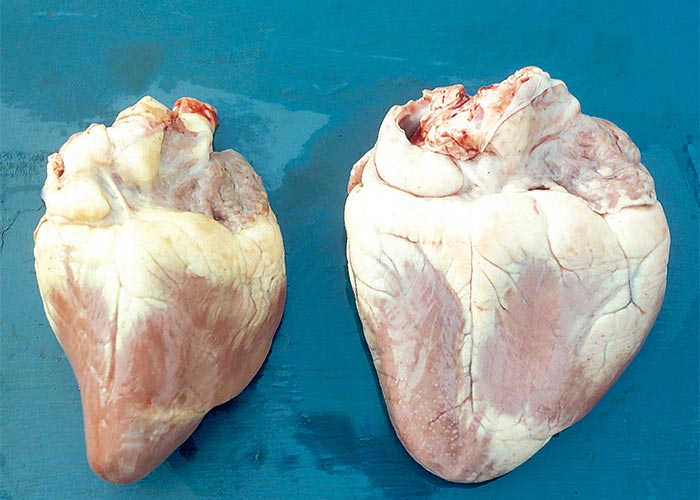 Cardiovascular system