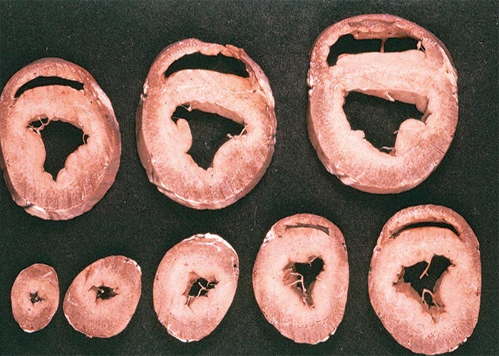 Cardiovascular system