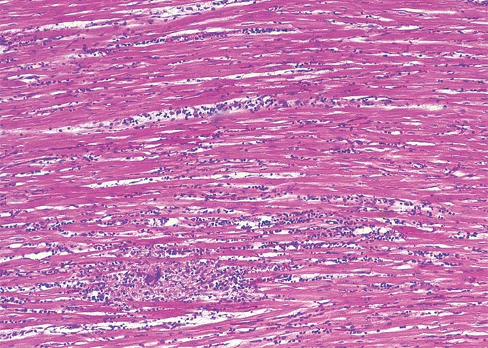 Cardiovascular system