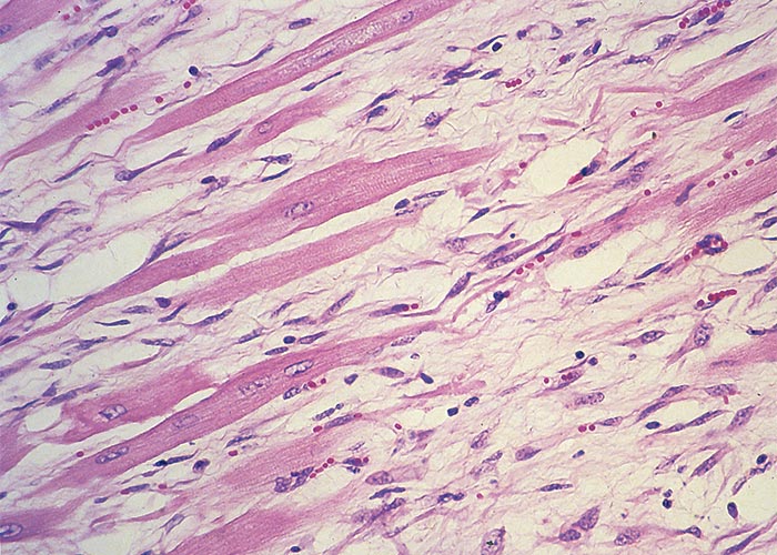 Cardiovascular system