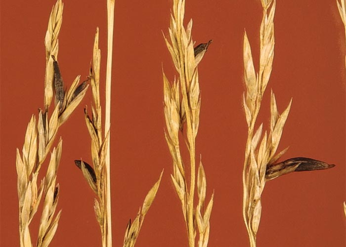 Cardiovascular system